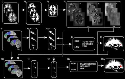 Distinct Components in the Right Extended Frontal Aslant Tract Mediate Language and Working Memory Performance: A Tractography-Informed VBM Study